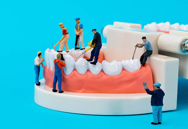 istock Miniature people cleaning teeth model on blue background 2235786611