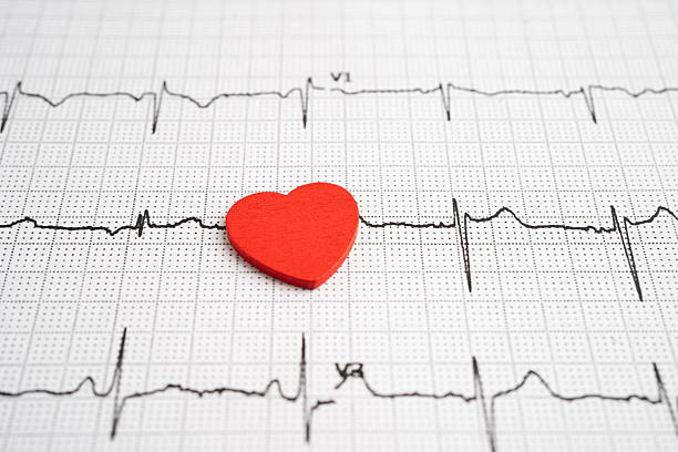 istock Electrocardiogram ECG heart wave, heart attack, cardiogram report. 2235859684