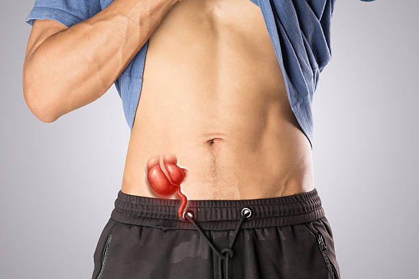 acute appendicitis causing severe abdominal pain - blindtarmsinflammation bildbanksfoton och bilder