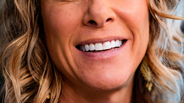 istock Close-Up of Natural Smile with White Teeth 2235990938