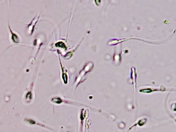 istock Normozoospermia sperm count normal semen analysis on microscopic examination. 2236059127