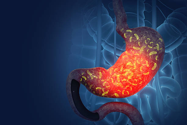 istock Viral gastroenteritis (stomach flu). human digestive system infected by virus or bacteria. 3d illustration 2236258412