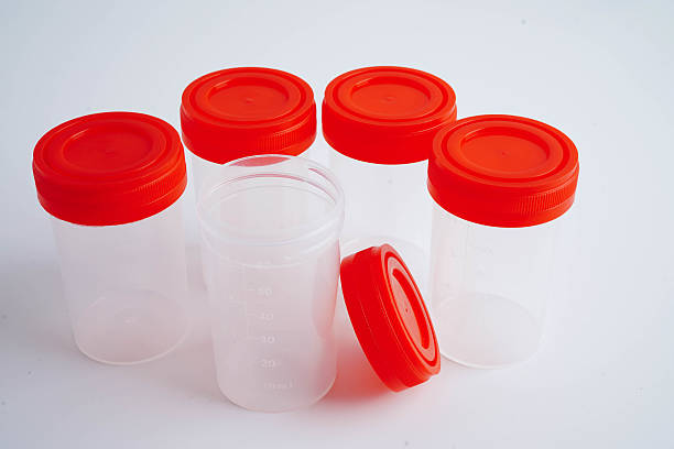 istock Urinalysis, urine cup for check health examination in laboratory. 2236352393