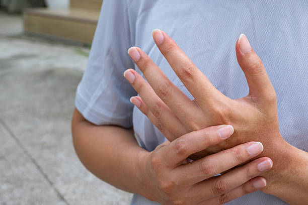 istock Individual with thumb and palm pain from strain or arthritis. 2236358463