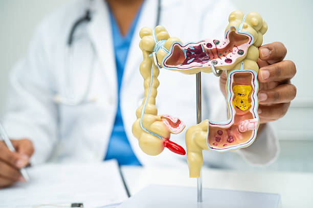 istock Intestine, appendix and digestive system, doctor holding anatomy model for study diagnosis and treatment in hospital. 2236666186