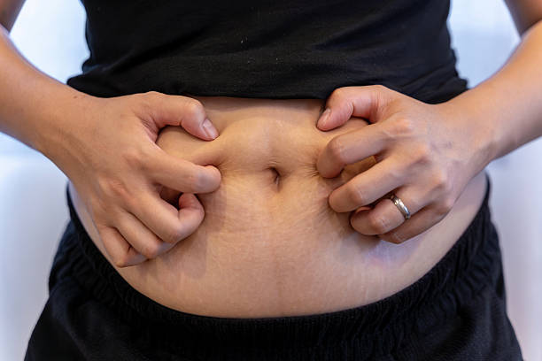 istock Woman squeezing belly fat with her hands 2236717383