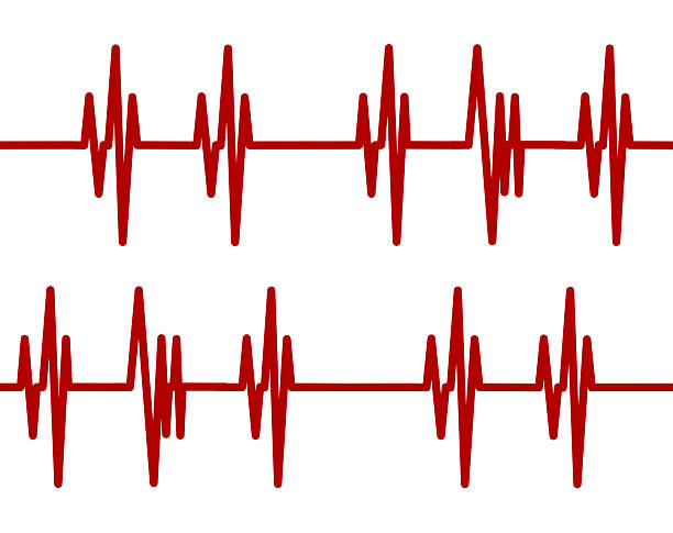 istock Repeating red heartbeat line on a white background. Medical EKG or ECG cardiogram illustration 2236887584