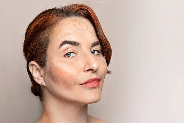 istock Red hair woman with pigmentation 2236936191