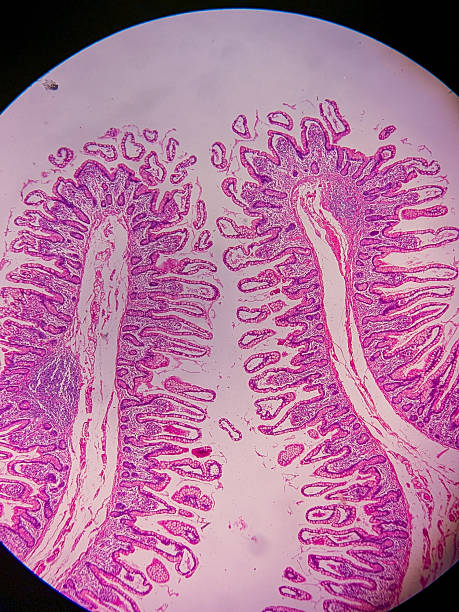 istock Ileum Histology with Villi and Crypt 2237038436