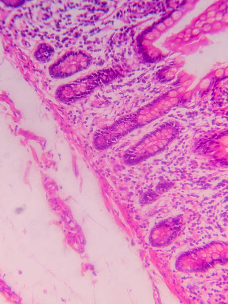 istock Ileum Histology with Villi and Crypt 2237039162