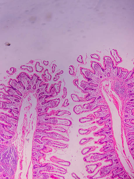 Ileum Histology with Villi and Crypt