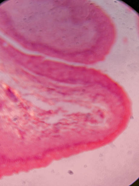 istock Histology of Normal Bladder Wall under the microscop 2237041416