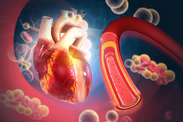 istock Cholesterol blocked artery with human heart 2237070784