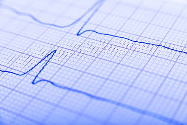 istock Health care background of Electrocardiogram plot 2237244437