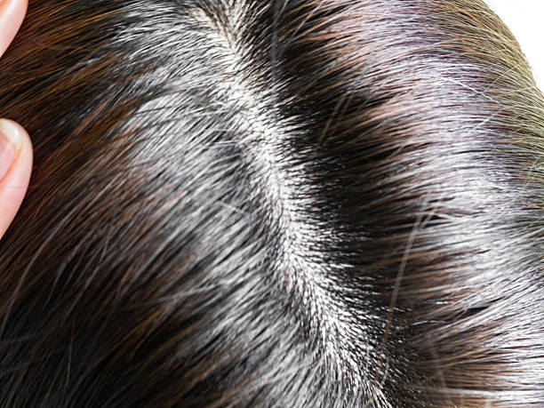 istock Scalp hair woman 2237260780
