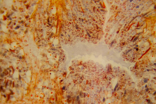 istock Planaria whole mount slide showing internal organs staine 2237296520