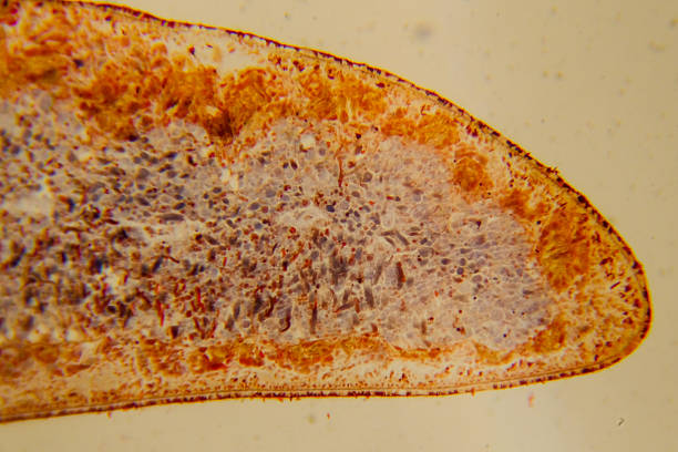 istock Planaria whole mount slide showing internal organs staine 2237296680