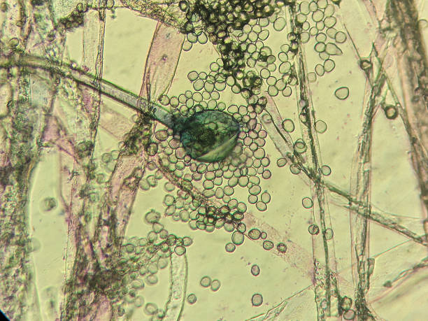 istock Fungal sporangium and hyphae under light microscop 2237299690