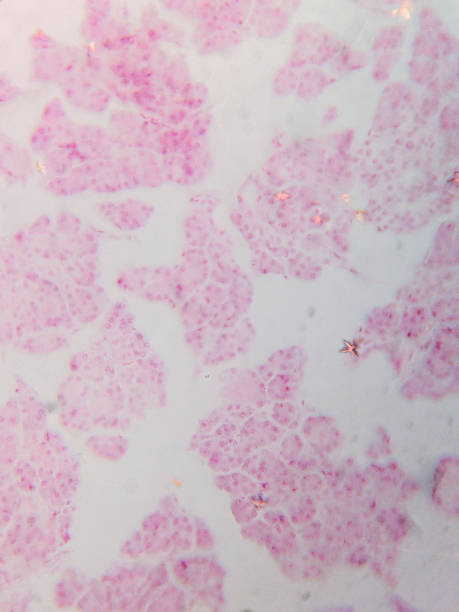 istock Histology of Human Pancreatic Acini 2237926794