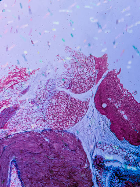 istock Cardiac Muscle Tissue and Endocardium 2237926840