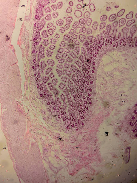 istock Human Jejunum with Villi and Crypt 2237926855