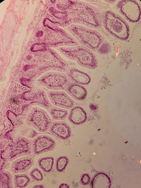 istock Human Jejunum with Villi and Crypt 2237926861