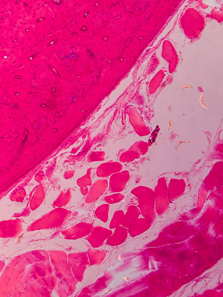 istock Adipose Tissue with Connective and Muscular 2237930357