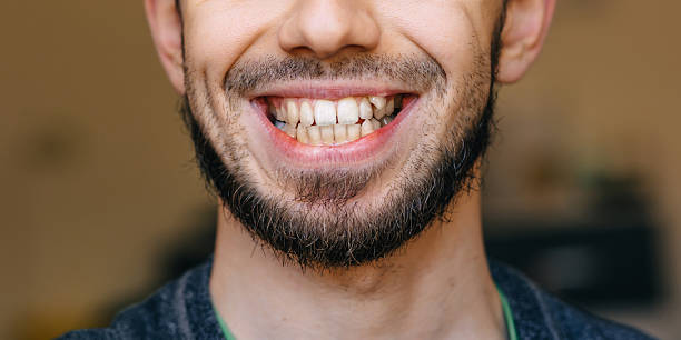 istock A man with bristles and an open mouth with uneven teeth 2238111540