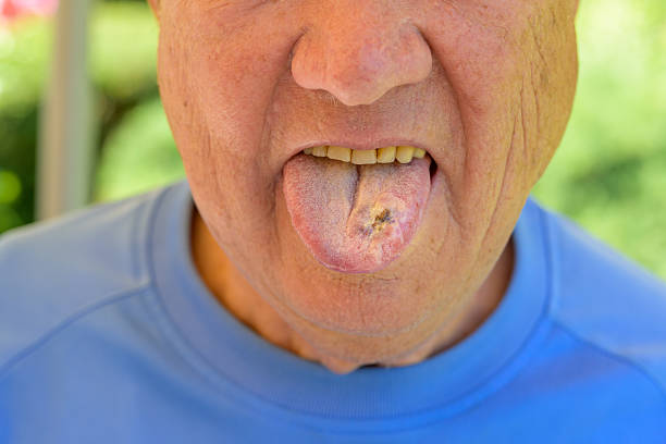 istock Senior showing tongue close-up 2238676872