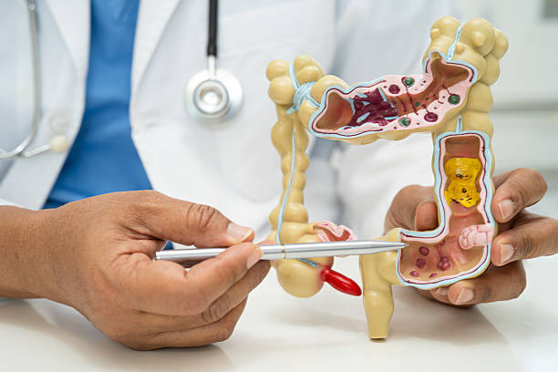 istock Intestine, appendix and digestive system, doctor holding anatomy model for study diagnosis and treatment in hospital. 2238872062