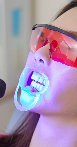 istock led teeth whitening treatment 2238916050