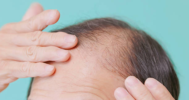 istock elderly man checking receding hairline 2238916135