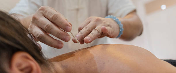 istock Acupuncturist treating patient with thin acupuncture needles 2239116071