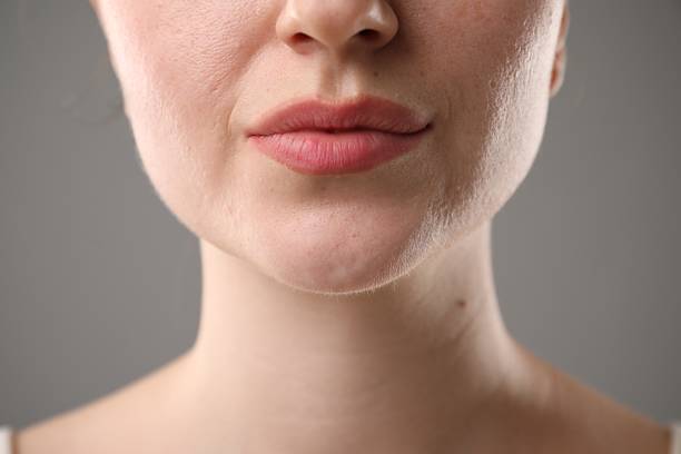 istock Woman before cosmetic procedure on grey background, closeup 2239443064