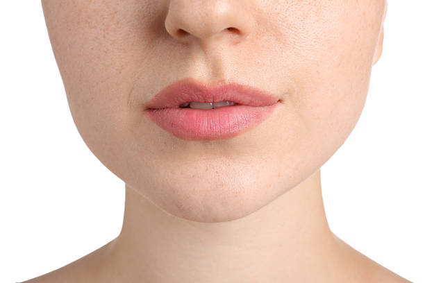 istock Woman before cosmetic procedure on white background, closeup 2239443207
