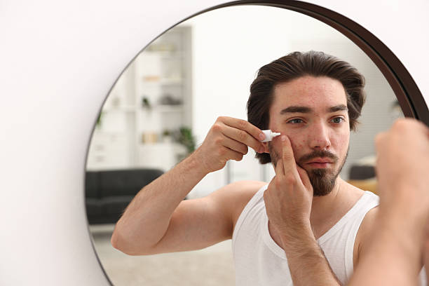 istock Young man with acne problem applying cream onto his face near mirror at home 2239443372