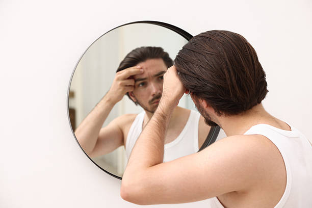 istock Young man with acne problem near mirror at home 2239444154