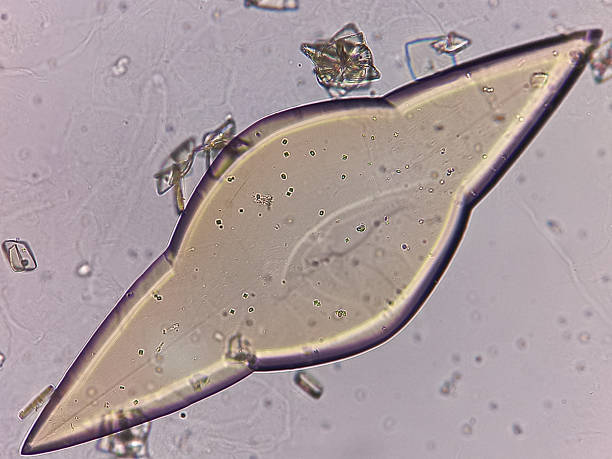 istock Uric acid crystal in urine. Microscopic image. 2239488954