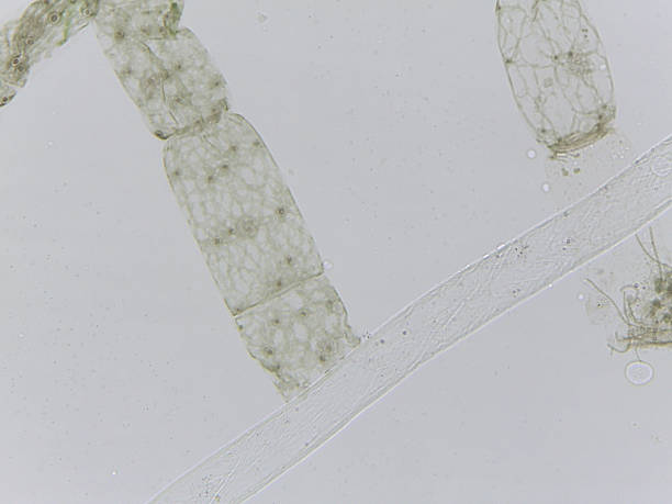 istock Microscopic View of Oedogonium Filaments 2239741794