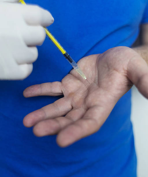 istock A man suffers from palmar hyperhidrosis. He wipes his sweaty palms due to excessive sweating. Treatment of hyperhidrosis with botulinum toxin injection into the hand. 2239906711