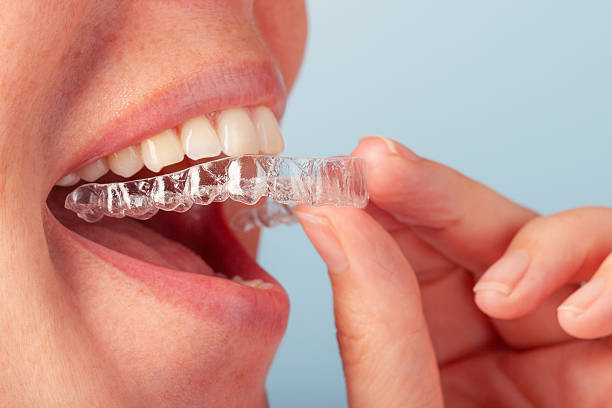 istock Close-Up of Dental Aligner 2240137248