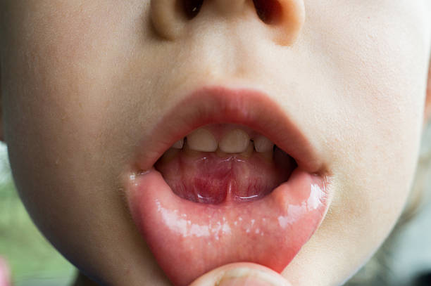 istock Boy showing his red gum 2240816989