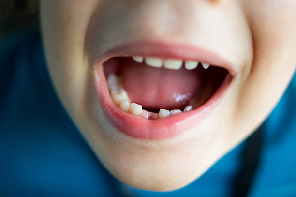 istock Child showing his teeth because he has lost a tooth 2240817024