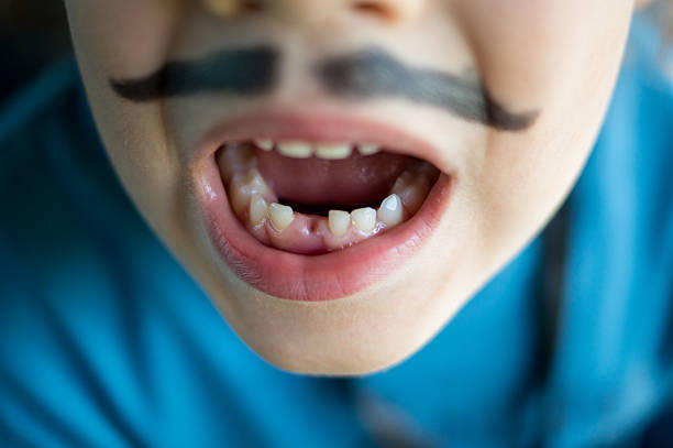 Close-up view of a child's mouth, revealing the simultaneous growth of permanent and baby teeth, highlighting the transition in dental development