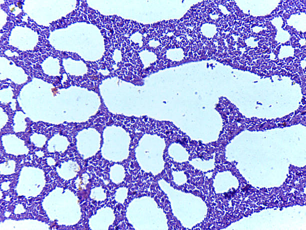 istock Microscopic view of lung tissue with alveoli 2240916514