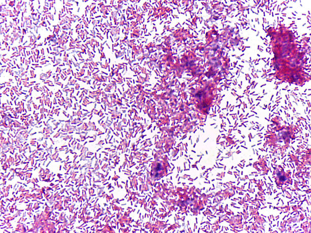 istock Microscopic view of bacteria in stained preparation 2240918969