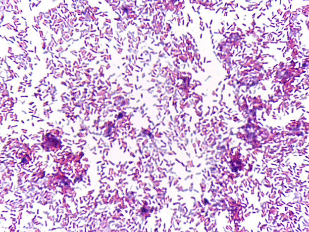 istock Microscopic view of bacteria in stained preparation 2240919024