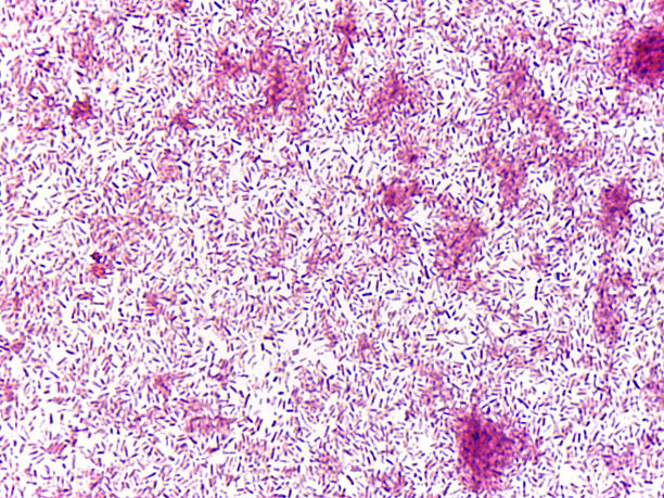 istock Microscopic view of bacteria in pink stain 2240929129