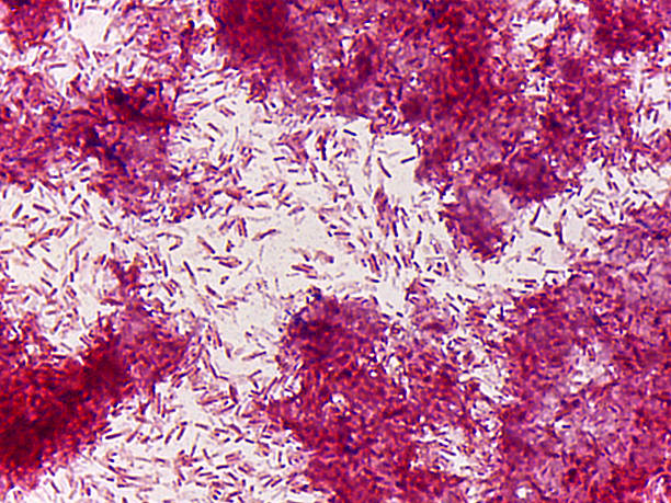 istock Microscopic view of stained bacteria culture 2240959992