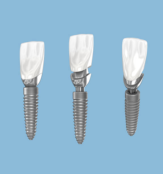 istock Dental implant and ceramic crown. 3D illustration. 2240964464